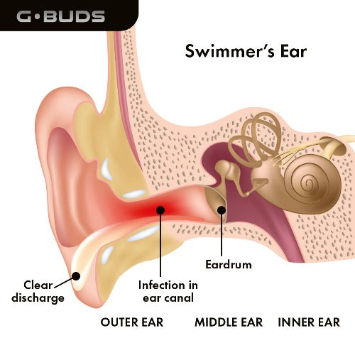 A set of blue G.BUDS surf ear plugs with a visual representation of sound levels indicating the waterproof feature.